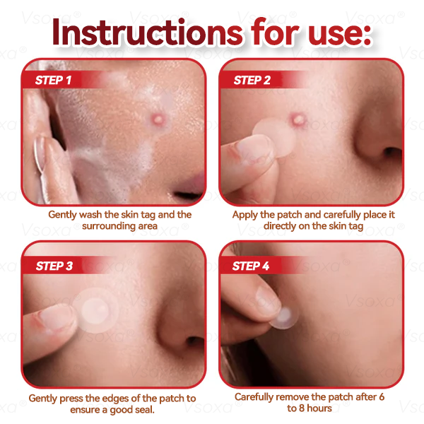🔥 2025 New Formula ⚡Cvreoz® Microneedle Skin Tag Removal Patches – Visible Results in 5 Days