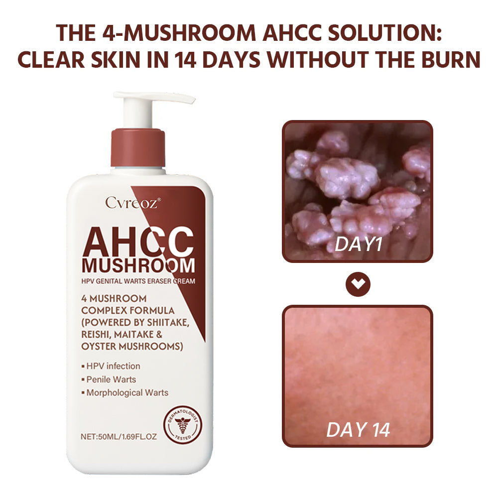 Cvreoz®AHCC Mushroom HPV Genital Warts Eraser Cream Pro