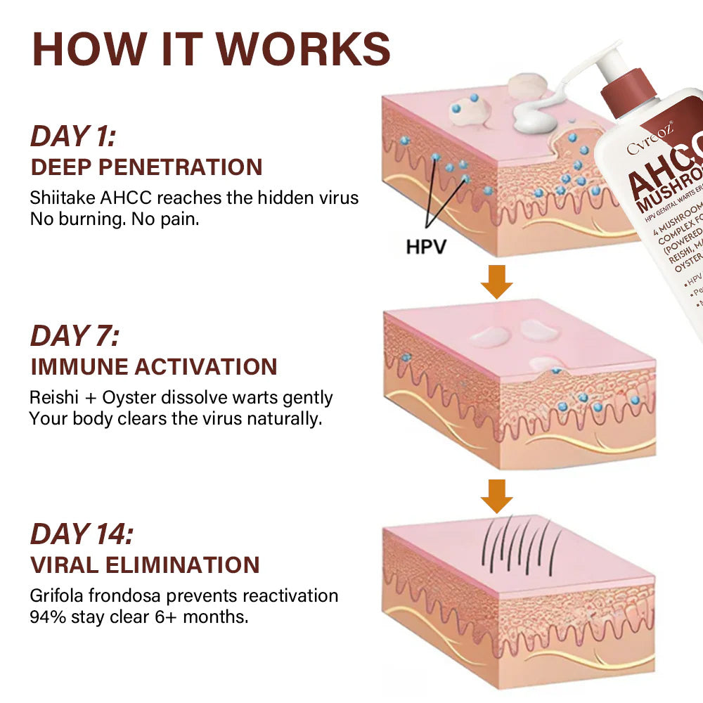 Cvreoz®AHCC Mushroom HPV Genital Warts Eraser Cream Pro