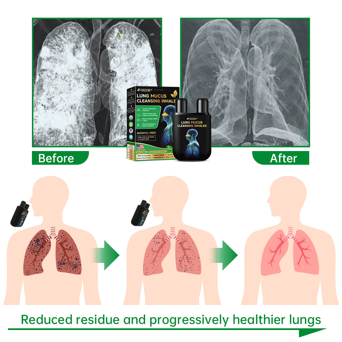 Raindew™ Lung Mucus Cleansing Inhaler(💝 Help smokers cleanse their lungs💝)