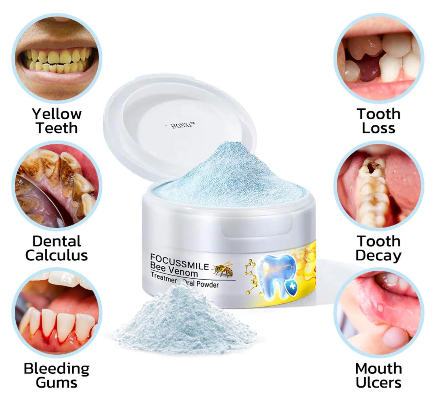 HONXI™ Focussmile Bee Venom Treatment Oral Powder🦷 (BDA Recommended)