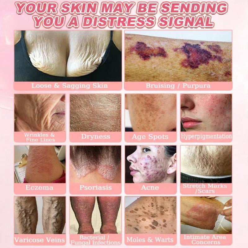 Cvreoz® 𝟗𝟗% 𝐩𝐮𝐫𝐞 𝐏𝐃𝐑𝐍 𝐒𝐚𝐥𝐦𝐨𝐧 𝐃𝐍𝐀 𝐀𝐧𝐭𝐢-𝐀𝐠𝐢𝐧𝐠 𝐀𝐦𝐩𝐨𝐮𝐥𝐞 𝘄𝗶𝘁𝗵 𝟵𝟵% 𝗦𝗮𝗹𝗺𝗼𝗻 𝗗𝗡𝗔 𝗣𝗗𝗥𝗡 + 𝗕𝗲𝗲 𝗩𝗲𝗻𝗼𝗺 · 𝟳𝗫 𝗗𝗲𝗲𝗽 𝗛𝘆𝗱𝗿𝗮𝘁𝗶𝗼𝗻 | 𝐓𝐚𝐫𝐠𝐞𝐭𝐬 𝐰𝐫𝐢𝐧𝐤𝐥𝐞𝐬, 𝐝𝐫𝐲𝐧𝐞𝐬𝐬, 𝐫𝐞𝐝𝐧𝐞𝐬𝐬, 𝐝𝐚𝐫𝐤 𝐬𝐩𝐨𝐭𝐬, 𝐩𝐮𝐫𝐩𝐮𝐫𝐚, 𝐢𝐧𝐟𝐥𝐚𝐦𝐦𝐚𝐭𝐢𝐨𝐧, 𝐚𝐧𝐝 𝐦𝐨𝐫𝐞 — 𝐕𝐢𝐬𝐢𝐛𝐥𝐞 𝐑𝐞𝐬𝐮𝐥𝐭𝐬 𝐢𝐧 𝟕 𝐃𝐚𝐲𝐬