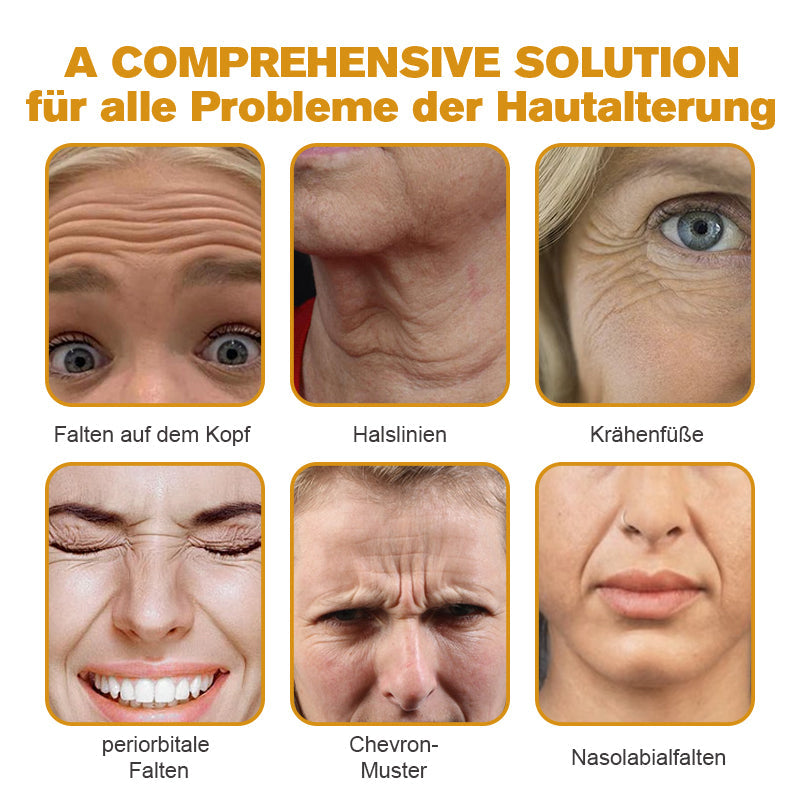 Letzter Tag der Aktion: 70 % Rabatt - ✨Cvreoz® Botox Bienenvenom Faltenentfernungscreme
