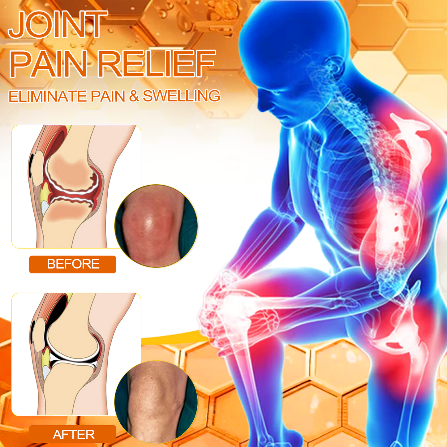 Official Store: ArthroEase™ Bee Venom Arthritis Therapy Cream (Joint & Bone Pain Relief in 24 Seconds)