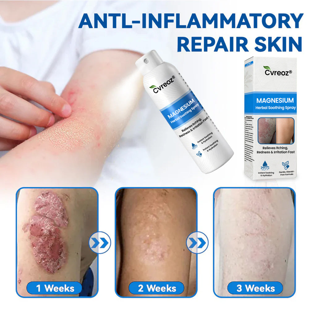 ✅  Official Store: Cvreoz® Magnesium Herbal Psoriasis Spray ⚕️ FDA Certified (for the treatment of psoriasis and eczema, improvement of bacterial infections in the genital area, treatment of acne and warts, eliminates psoriasis and eczema, etc.)