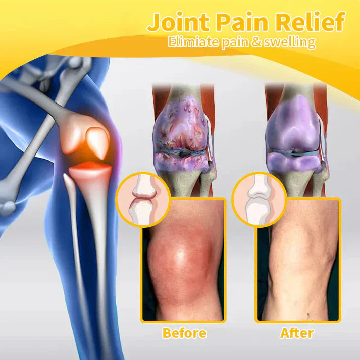 ✅Official Store: flysmus™ Bee-Venom Pain-Relief Bone Healing Cream👨‍⚕️United States Pharmacopeia (USP) Approved(Reducing joint swelling, pain, stiffness, warmth,redness,  soreness, and joint fatigue)