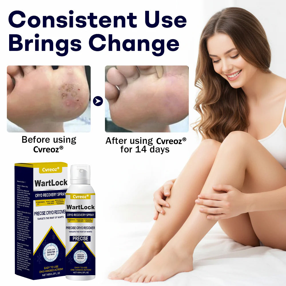 7视频🎅 𝘾𝙝𝙧𝙞𝙨𝙩𝙢𝙖𝙨 𝙎𝙖𝙡𝙚 | Cvreoz® WartLock CRYO RECOVERY SPRAY