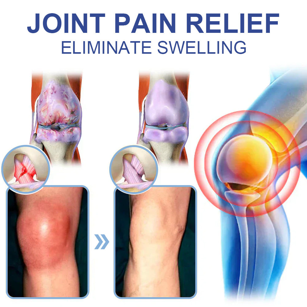 ✅Offiziell empfohlen: KUBOZN® Magnesium-Intensivcreme gegen Gelenk- und Nervenschmerzen (bei Arthrose, Neuropathie, Rheuma, Sportverletzungen u. v. m.)