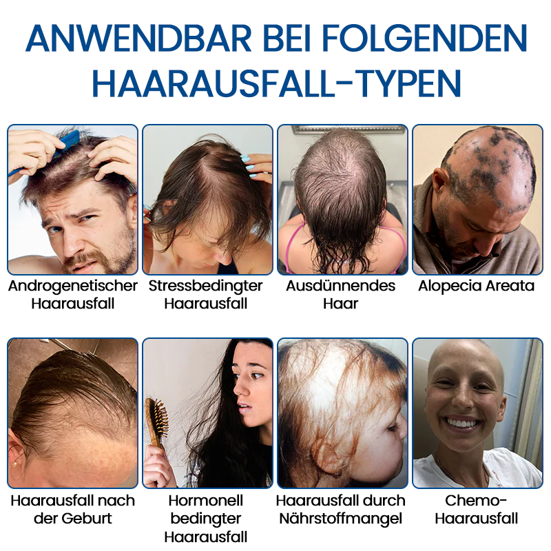 ✅Offizieller Shop: KUBOZN® STAMMZELLEN Haarzyklus-Roller (Haarwuchs-Roller mit pflanzlichen Stammzellen & Multi-Peptiden)