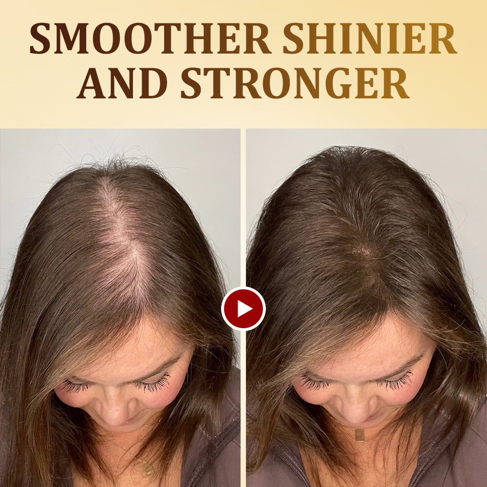 👨‍⚕️✅US FDA APPROVED | Furzero™ Ginger Infused Collagen Repair Conditioner🌟