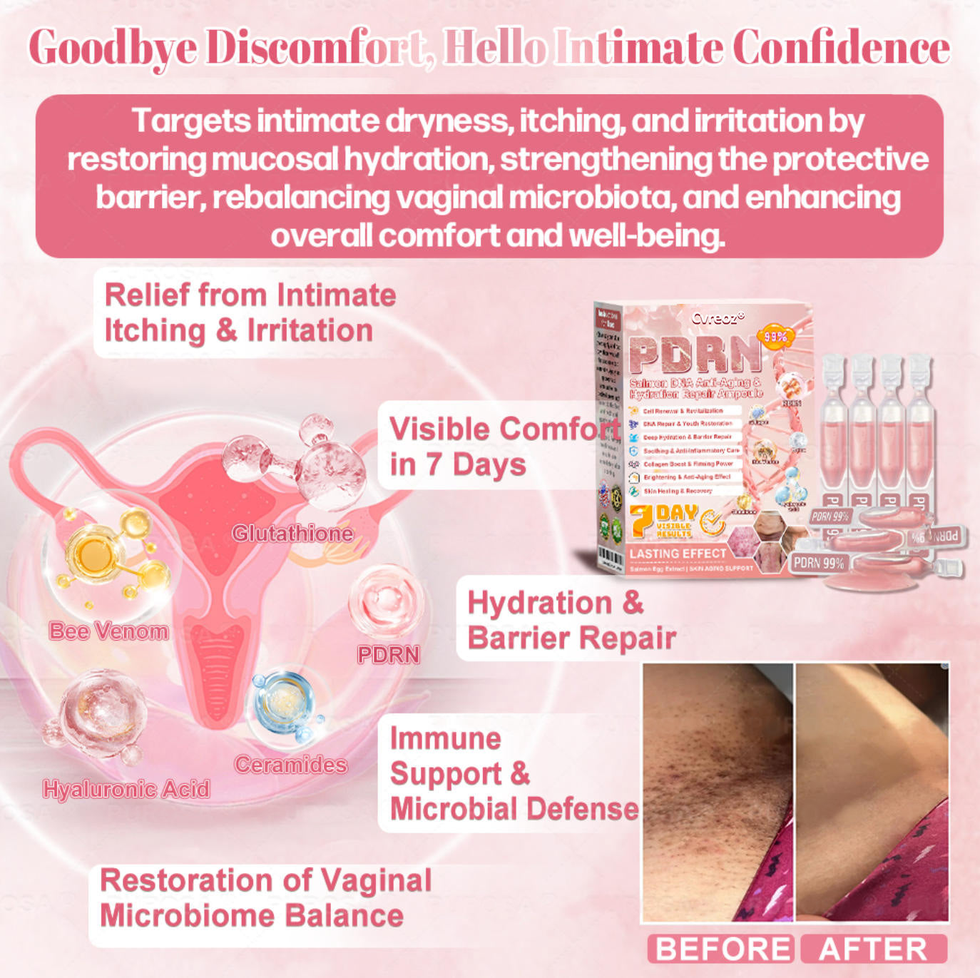 Cvreoz® 𝟗𝟗% 𝐩𝐮𝐫𝐞 𝐏𝐃𝐑𝐍 𝐒𝐚𝐥𝐦𝐨𝐧 𝐃𝐍𝐀 𝐀𝐧𝐭𝐢-𝐀𝐠𝐢𝐧𝐠 𝐀𝐦𝐩𝐨𝐮𝐥𝐞 𝘄𝗶𝘁𝗵 𝟵𝟵% 𝗦𝗮𝗹𝗺𝗼𝗻 𝗗𝗡𝗔 𝗣𝗗𝗥𝗡 + 𝗕𝗲𝗲 𝗩𝗲𝗻𝗼𝗺 · 𝟳𝗫 𝗗𝗲𝗲𝗽 𝗛𝘆𝗱𝗿𝗮𝘁𝗶𝗼𝗻 | 𝐓𝐚𝐫𝐠𝐞𝐭𝐬 𝐰𝐫𝐢𝐧𝐤𝐥𝐞𝐬, 𝐝𝐫𝐲𝐧𝐞𝐬𝐬, 𝐫𝐞𝐝𝐧𝐞𝐬𝐬, 𝐝𝐚𝐫𝐤 𝐬𝐩𝐨𝐭𝐬, 𝐩𝐮𝐫𝐩𝐮𝐫𝐚, 𝐢𝐧𝐟𝐥𝐚𝐦𝐦𝐚𝐭𝐢𝐨𝐧, 𝐚𝐧𝐝 𝐦𝐨𝐫𝐞 — 𝐕𝐢𝐬𝐢𝐛𝐥𝐞 𝐑𝐞𝐬𝐮𝐥𝐭𝐬 𝐢𝐧 𝟕 𝐃𝐚𝐲𝐬