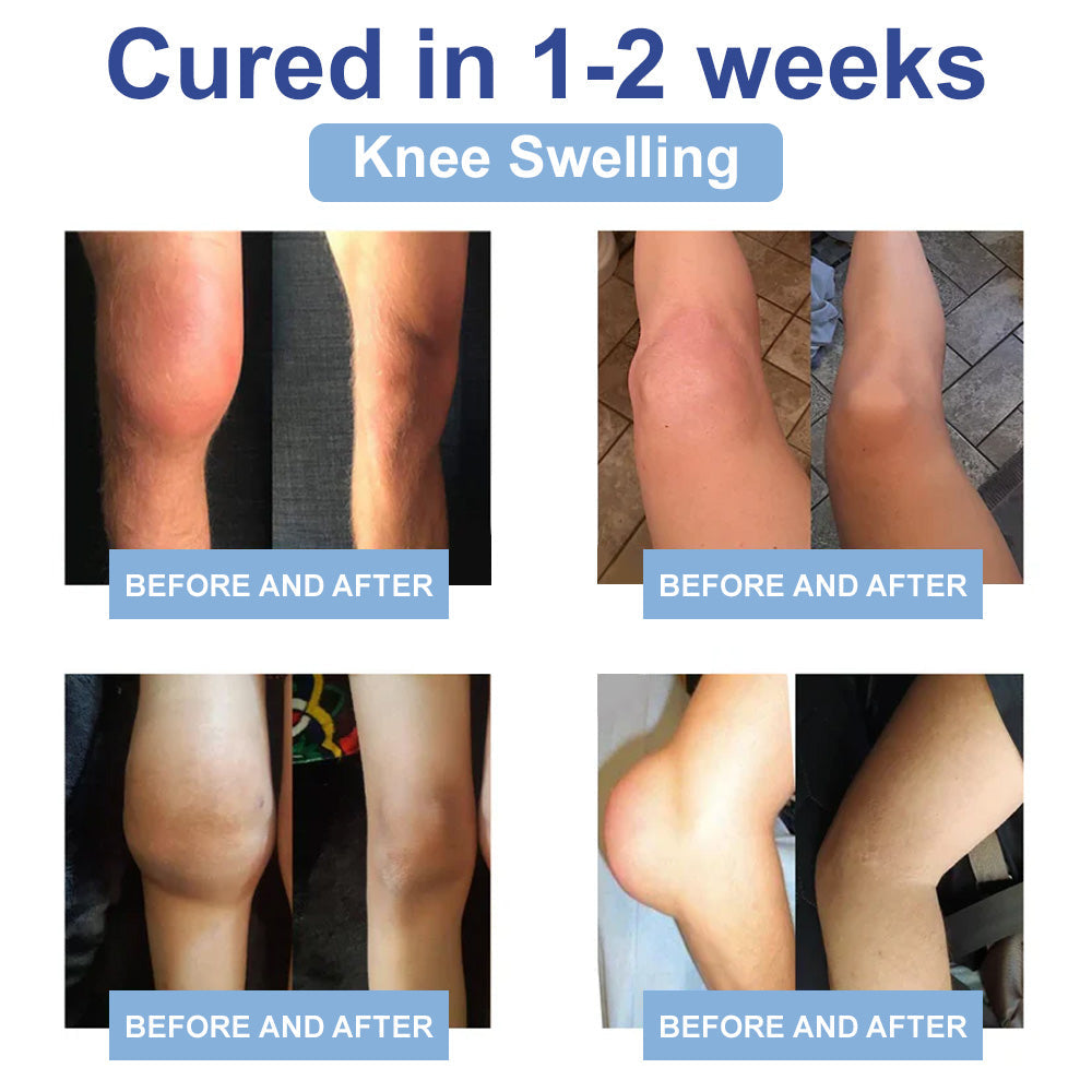 ✅Offiziell empfohlen: KUBOZN® Magnesium-Intensivcreme gegen Gelenk- und Nervenschmerzen (bei Arthrose, Neuropathie, Rheuma, Sportverletzungen u. v. m.)