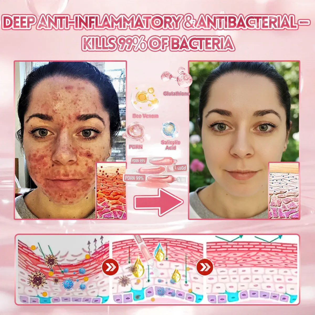 Cvreoz® 𝟗𝟗% 𝐩𝐮𝐫𝐞 𝐏𝐃𝐑𝐍 𝐒𝐚𝐥𝐦𝐨𝐧 𝐃𝐍𝐀 𝐀𝐧𝐭𝐢-𝐀𝐠𝐢𝐧𝐠 𝐀𝐦𝐩𝐨𝐮𝐥𝐞 𝘄𝗶𝘁𝗵 𝟵𝟵% 𝗦𝗮𝗹𝗺𝗼𝗻 𝗗𝗡𝗔 𝗣𝗗𝗥𝗡 + 𝗕𝗲𝗲 𝗩𝗲𝗻𝗼𝗺 · 𝟳𝗫 𝗗𝗲𝗲𝗽 𝗛𝘆𝗱𝗿𝗮𝘁𝗶𝗼𝗻 | 𝐓𝐚𝐫𝐠𝐞𝐭𝐬 𝐰𝐫𝐢𝐧𝐤𝐥𝐞𝐬, 𝐝𝐫𝐲𝐧𝐞𝐬𝐬, 𝐫𝐞𝐝𝐧𝐞𝐬𝐬, 𝐝𝐚𝐫𝐤 𝐬𝐩𝐨𝐭𝐬, 𝐩𝐮𝐫𝐩𝐮𝐫𝐚, 𝐢𝐧𝐟𝐥𝐚𝐦𝐦𝐚𝐭𝐢𝐨𝐧, 𝐚𝐧𝐝 𝐦𝐨𝐫𝐞 — 𝐕𝐢𝐬𝐢𝐛𝐥𝐞 𝐑𝐞𝐬𝐮𝐥𝐭𝐬 𝐢𝐧 𝟕 𝐃𝐚𝐲𝐬