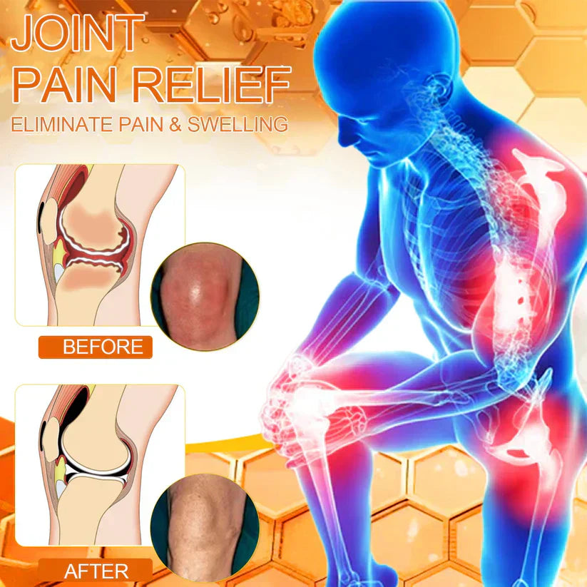 ✅Official Store: flysmus™ Bee-Venom Pain-Relief Bone Healing Cream👨‍⚕️United States Pharmacopeia (USP) Approved(Reducing joint swelling, pain, stiffness, warmth,redness,  soreness, and joint fatigue)