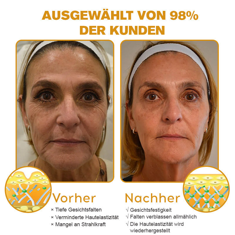 Letzter Tag der Aktion: 70 % Rabatt - ✨Cvreoz® Botox Bienenvenom Faltenentfernungscreme