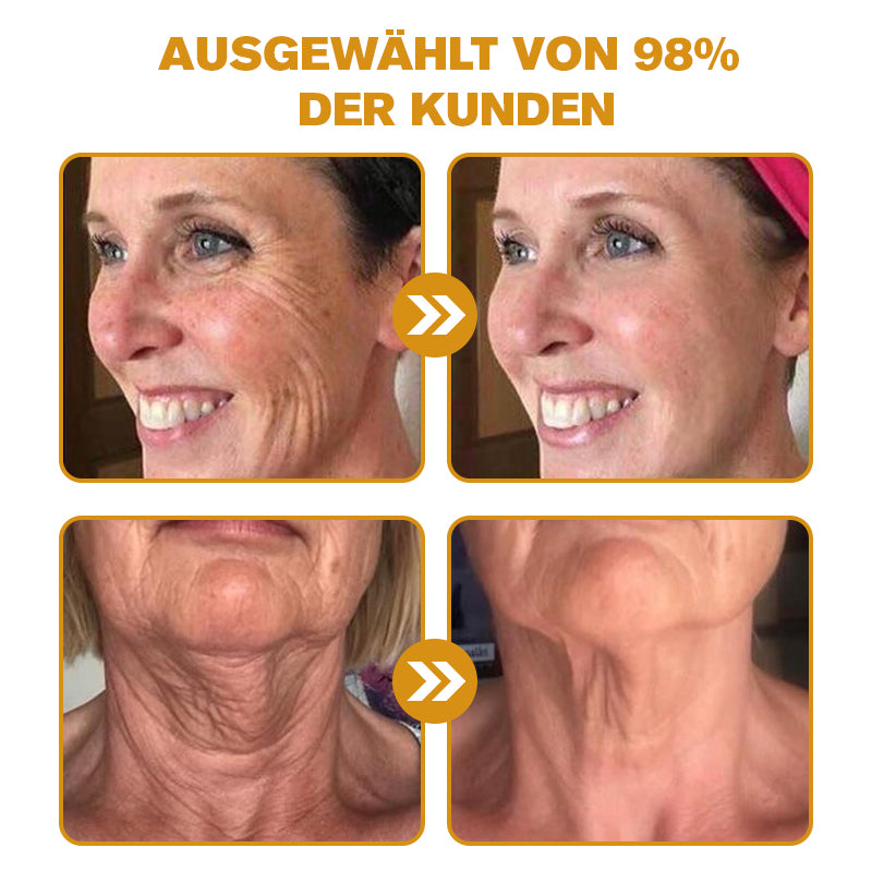 Letzter Tag der Aktion: 70 % Rabatt - ✨Cvreoz® Botox Bienenvenom Faltenentfernungscreme