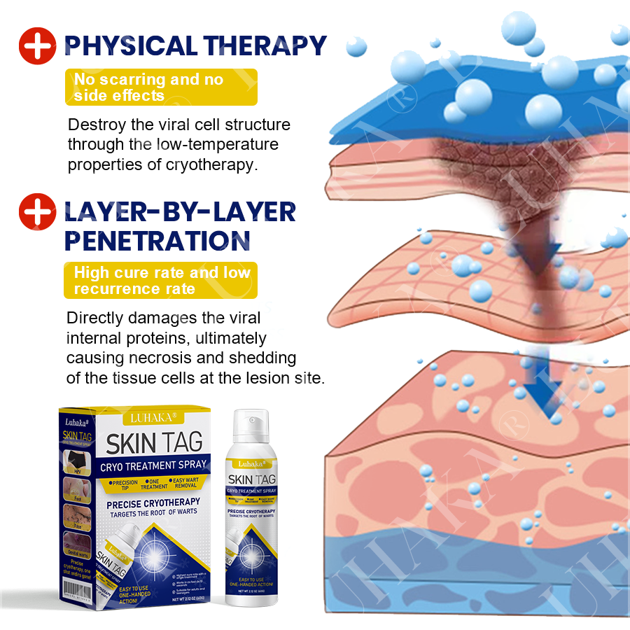 LUHAKA® SKIN TAG CRYO TREATMENT SPRAY ACE