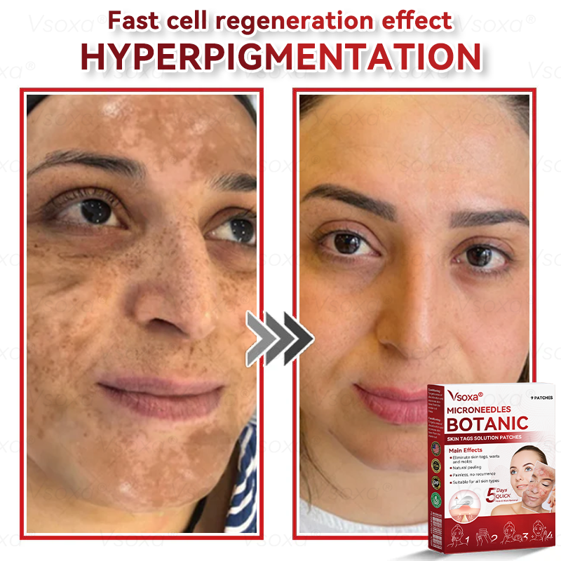 🔥 2025 New Formula ⚡Cvreoz® Microneedle Skin Tag Removal Patches – Visible Results in 5 Days