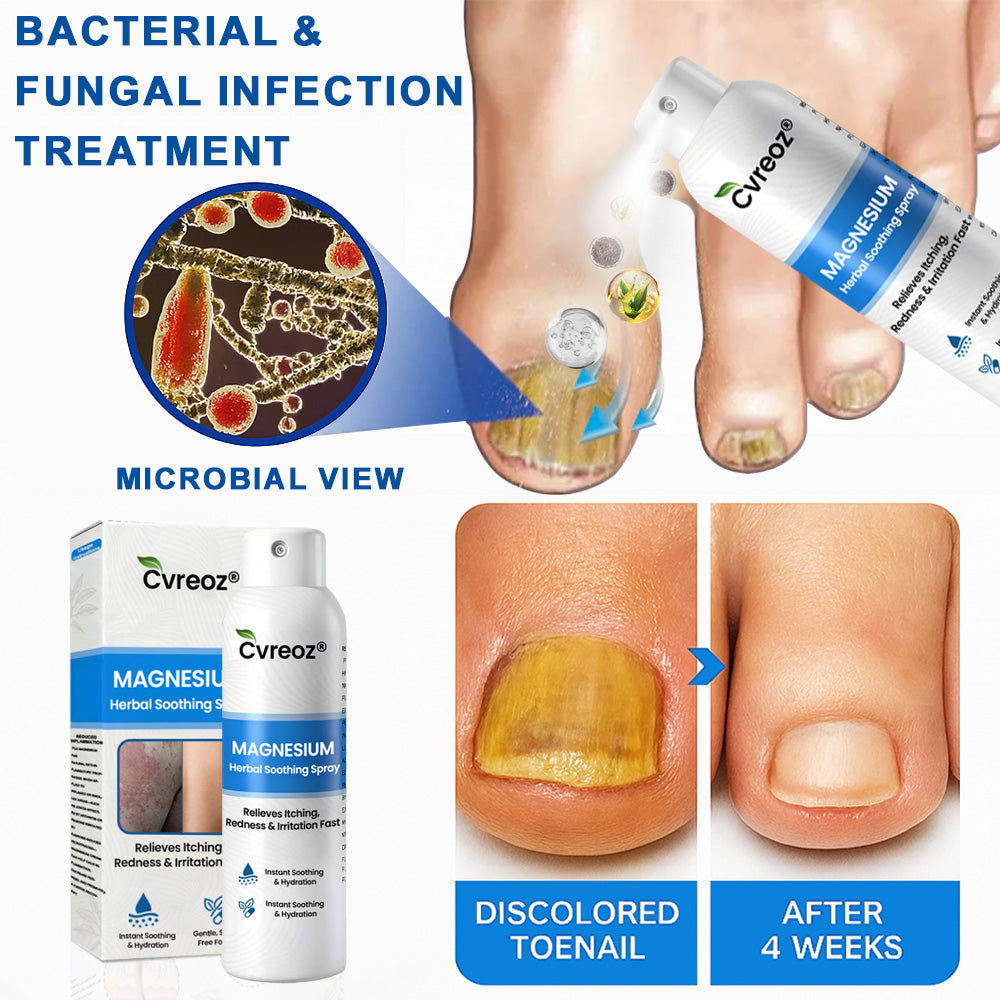 ✅  Official Store: Cvreoz® Magnesium Herbal Psoriasis Spray ⚕️ FDA Certified (for the treatment of psoriasis and eczema, improvement of bacterial infections in the genital area, treatment of acne and warts, eliminates psoriasis and eczema, etc.)