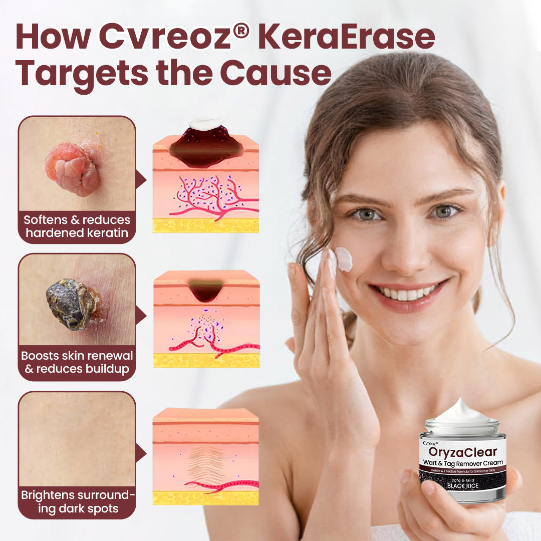 ⭐ Cvreoz® OryzaClear – Black Rice Power Cream for Skin Tags & Bumps · Gentle Plant-Based Softening Formula