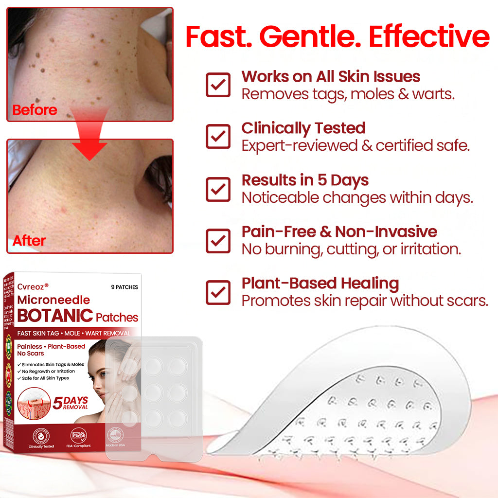 🔥 2025 New Formula ⚡Cvreoz® Microneedle Skin Tag Removal Patches – Visible Results in 5 Days