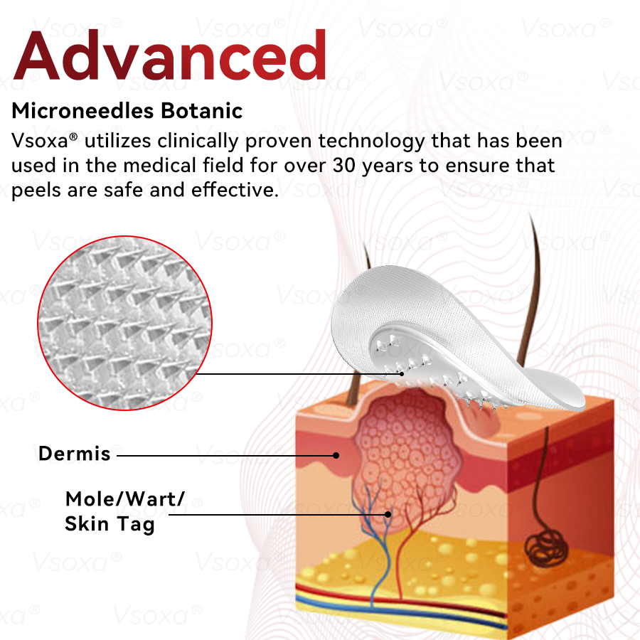 🔥 2025 New Formula ⚡Cvreoz® Microneedle Skin Tag Removal Patches – Visible Results in 5 Days
