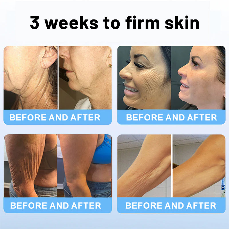 🔮🐧KUBOZN™ Collagen Peptides FIRMING SERUM