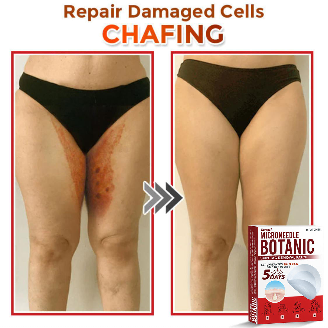 Cvreoz® MicroNeedle Botanic Skin Tag Removal Patch 🇺🇸 Made in the USA
