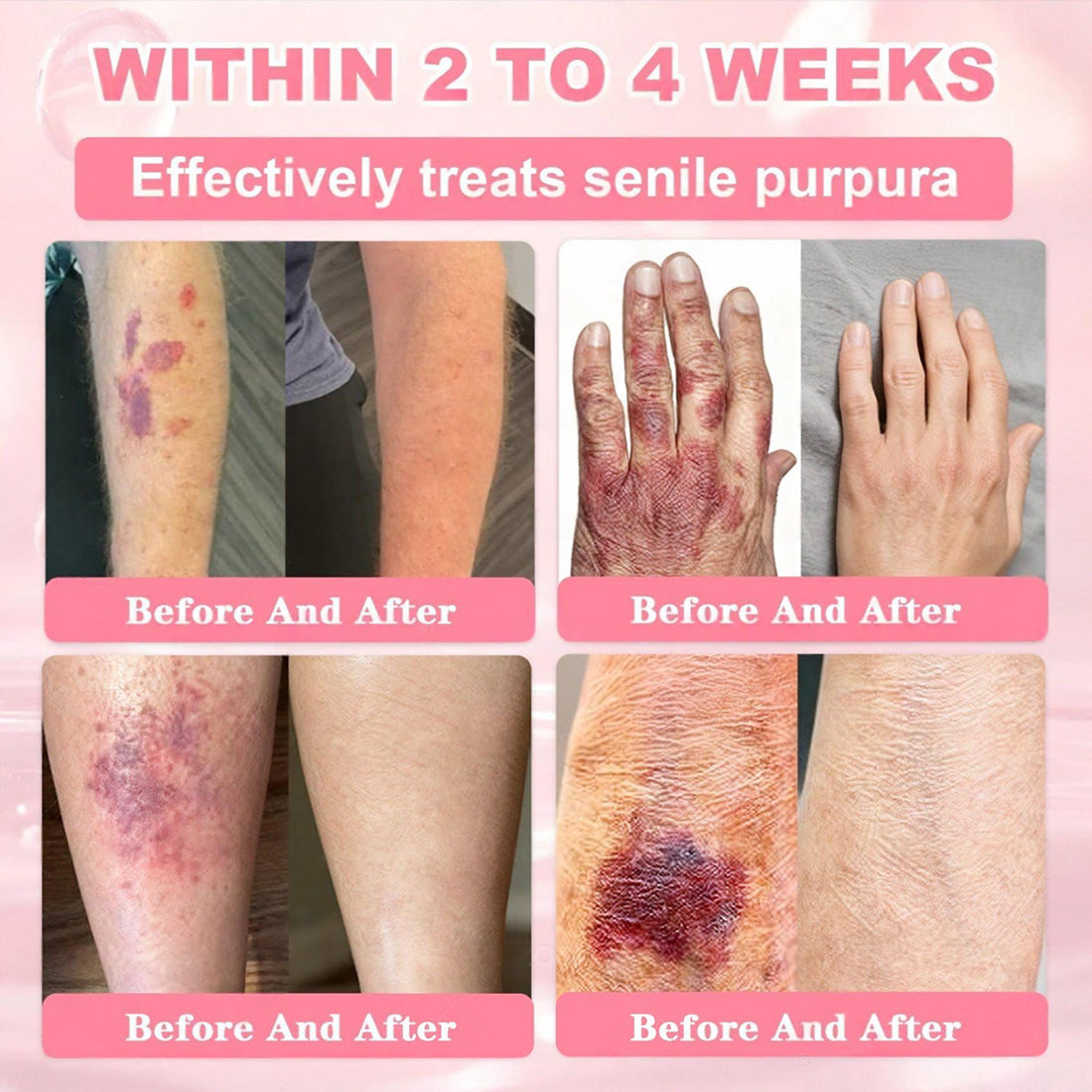 Cvreoz® 𝟗𝟗% 𝐩𝐮𝐫𝐞 𝐏𝐃𝐑𝐍 𝐒𝐚𝐥𝐦𝐨𝐧 𝐃𝐍𝐀 𝐀𝐧𝐭𝐢-𝐀𝐠𝐢𝐧𝐠 𝐀𝐦𝐩𝐨𝐮𝐥𝐞 𝘄𝗶𝘁𝗵 𝟵𝟵% 𝗦𝗮𝗹𝗺𝗼𝗻 𝗗𝗡𝗔 𝗣𝗗𝗥𝗡 + 𝗕𝗲𝗲 𝗩𝗲𝗻𝗼𝗺 · 𝟳𝗫 𝗗𝗲𝗲𝗽 𝗛𝘆𝗱𝗿𝗮𝘁𝗶𝗼𝗻 | 𝐓𝐚𝐫𝐠𝐞𝐭𝐬 𝐰𝐫𝐢𝐧𝐤𝐥𝐞𝐬, 𝐝𝐫𝐲𝐧𝐞𝐬𝐬, 𝐫𝐞𝐝𝐧𝐞𝐬𝐬, 𝐝𝐚𝐫𝐤 𝐬𝐩𝐨𝐭𝐬, 𝐩𝐮𝐫𝐩𝐮𝐫𝐚, 𝐢𝐧𝐟𝐥𝐚𝐦𝐦𝐚𝐭𝐢𝐨𝐧, 𝐚𝐧𝐝 𝐦𝐨𝐫𝐞 — 𝐕𝐢𝐬𝐢𝐛𝐥𝐞 𝐑𝐞𝐬𝐮𝐥𝐭𝐬 𝐢𝐧 𝟕 𝐃𝐚𝐲𝐬