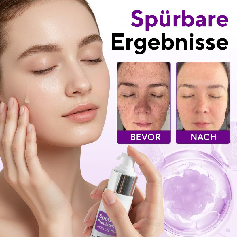 Cvreoz® SpotErase Probiotisches Schutzserum