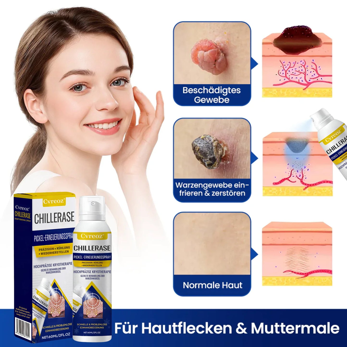 Fivfivgo® ChillErase Pickel-Erneuerungsspray