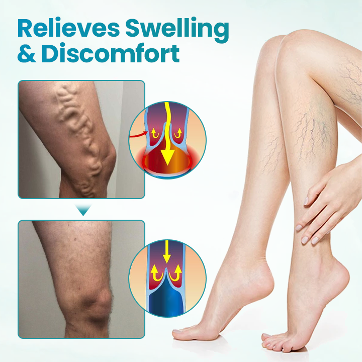 Croaie® VeinAway Relief Cream