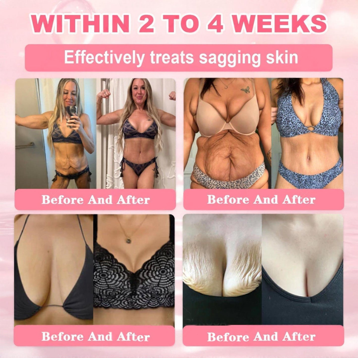 Cvreoz® 𝟗𝟗% 𝐩𝐮𝐫𝐞 𝐏𝐃𝐑𝐍 𝐒𝐚𝐥𝐦𝐨𝐧 𝐃𝐍𝐀 𝐀𝐧𝐭𝐢-𝐀𝐠𝐢𝐧𝐠 𝐀𝐦𝐩𝐨𝐮𝐥𝐞 𝘄𝗶𝘁𝗵 𝟵𝟵% 𝗦𝗮𝗹𝗺𝗼𝗻 𝗗𝗡𝗔 𝗣𝗗𝗥𝗡 + 𝗕𝗲𝗲 𝗩𝗲𝗻𝗼𝗺 · 𝟳𝗫 𝗗𝗲𝗲𝗽 𝗛𝘆𝗱𝗿𝗮𝘁𝗶𝗼𝗻 | 𝐓𝐚𝐫𝐠𝐞𝐭𝐬 𝐰𝐫𝐢𝐧𝐤𝐥𝐞𝐬, 𝐝𝐫𝐲𝐧𝐞𝐬𝐬, 𝐫𝐞𝐝𝐧𝐞𝐬𝐬, 𝐝𝐚𝐫𝐤 𝐬𝐩𝐨𝐭𝐬, 𝐩𝐮𝐫𝐩𝐮𝐫𝐚, 𝐢𝐧𝐟𝐥𝐚𝐦𝐦𝐚𝐭𝐢𝐨𝐧, 𝐚𝐧𝐝 𝐦𝐨𝐫𝐞 — 𝐕𝐢𝐬𝐢𝐛𝐥𝐞 𝐑𝐞𝐬𝐮𝐥𝐭𝐬 𝐢𝐧 𝟕 𝐃𝐚𝐲𝐬