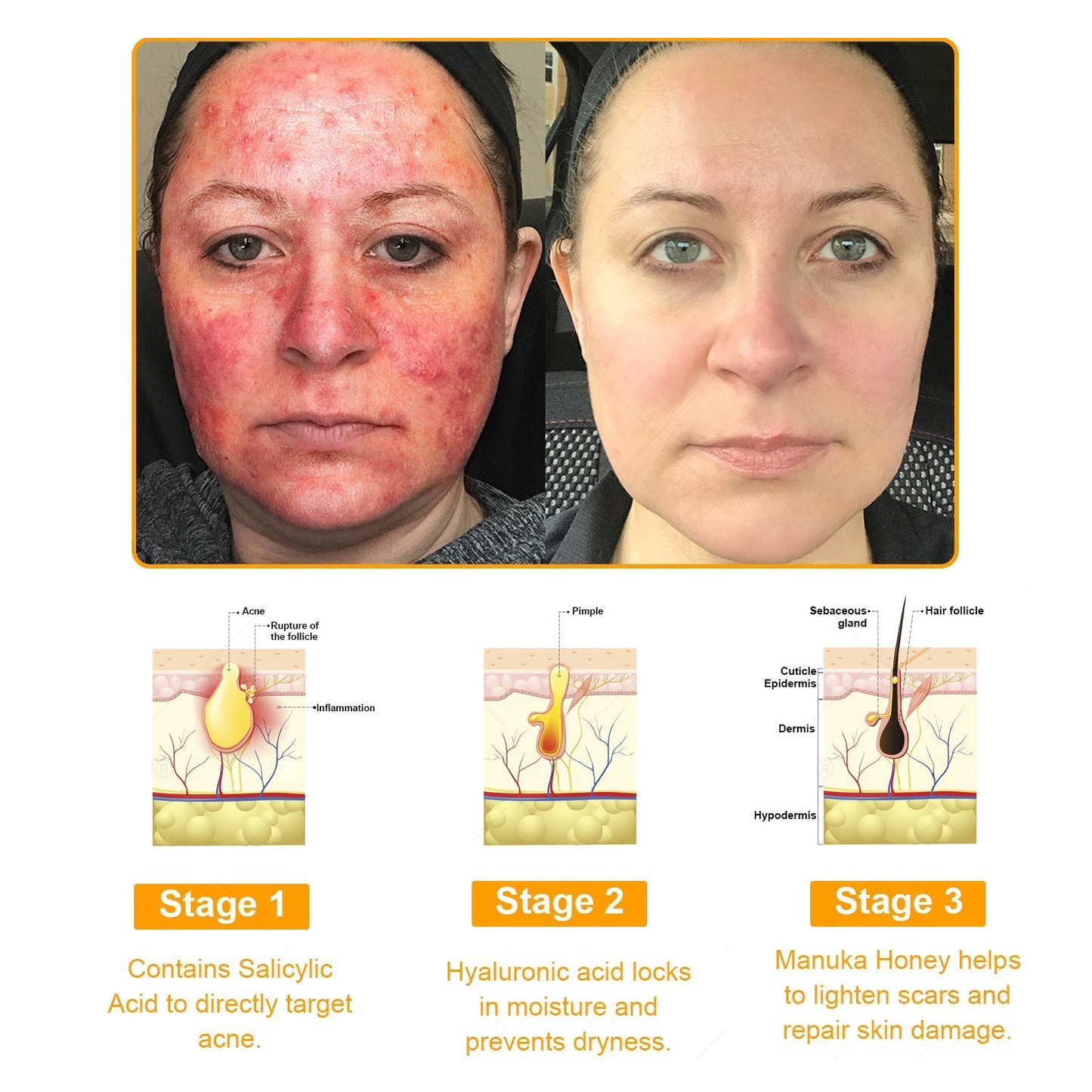 KUBOZN™ 7-Day Multi-Effect All-in-One Skincare Cream—Professionally Supported by AAD💎