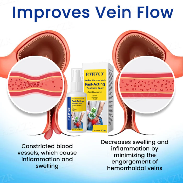 Fivfivgo® Herbal Hemorrhoids Fast-Acting Treatment Spray