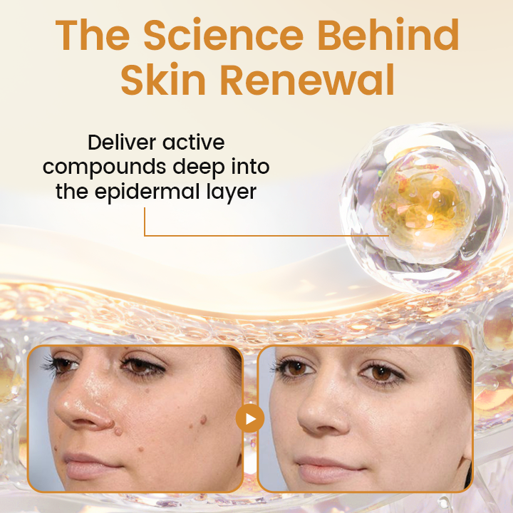 Healrize® BeeVenom Wart Renewal Spray