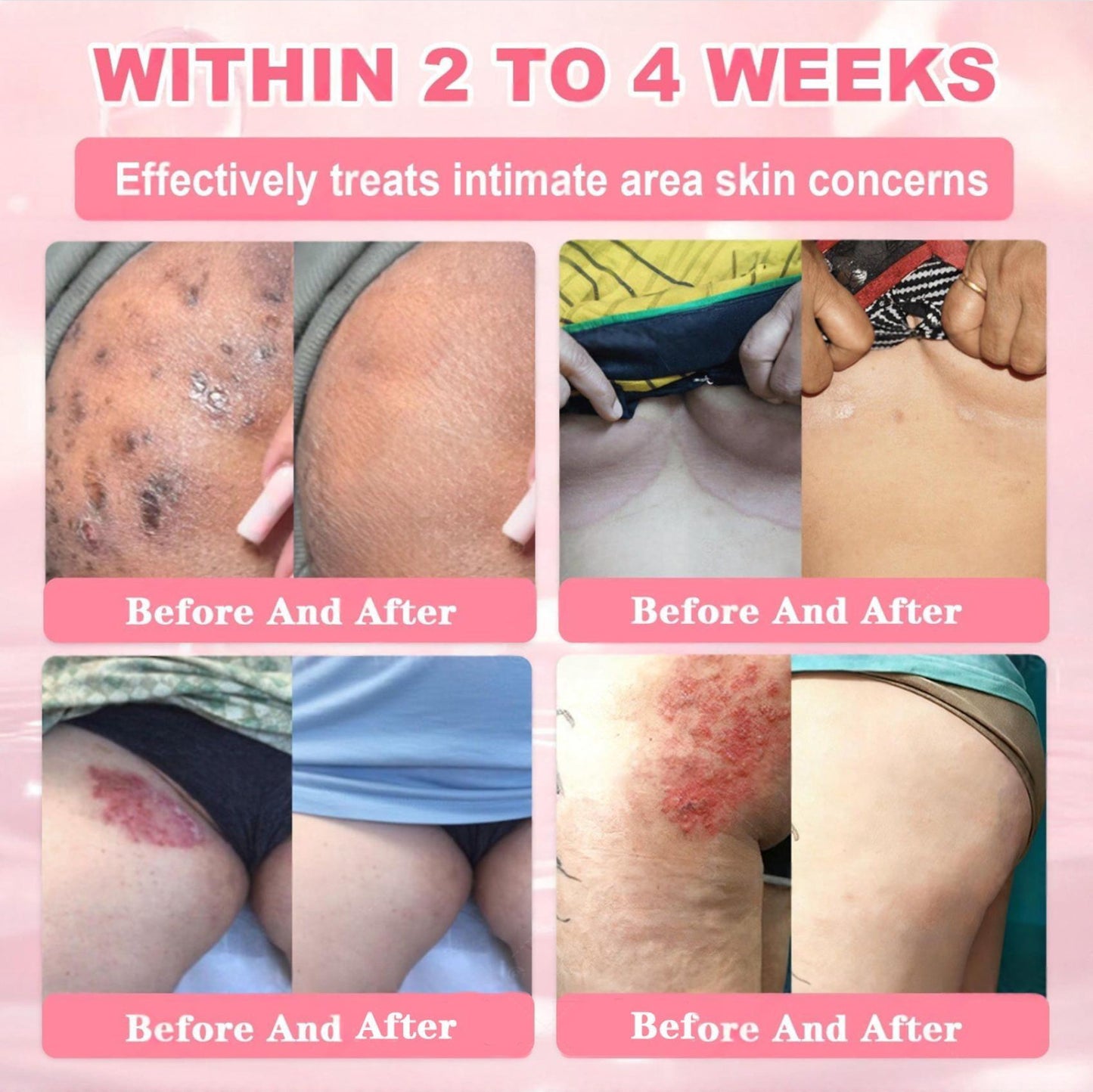 Cvreoz® 𝟗𝟗% 𝐩𝐮𝐫𝐞 𝐏𝐃𝐑𝐍 𝐒𝐚𝐥𝐦𝐨𝐧 𝐃𝐍𝐀 𝐀𝐧𝐭𝐢-𝐀𝐠𝐢𝐧𝐠 𝐀𝐦𝐩𝐨𝐮𝐥𝐞 𝘄𝗶𝘁𝗵 𝟵𝟵% 𝗦𝗮𝗹𝗺𝗼𝗻 𝗗𝗡𝗔 𝗣𝗗𝗥𝗡 + 𝗕𝗲𝗲 𝗩𝗲𝗻𝗼𝗺 · 𝟳𝗫 𝗗𝗲𝗲𝗽 𝗛𝘆𝗱𝗿𝗮𝘁𝗶𝗼𝗻 | 𝐓𝐚𝐫𝐠𝐞𝐭𝐬 𝐰𝐫𝐢𝐧𝐤𝐥𝐞𝐬, 𝐝𝐫𝐲𝐧𝐞𝐬𝐬, 𝐫𝐞𝐝𝐧𝐞𝐬𝐬, 𝐝𝐚𝐫𝐤 𝐬𝐩𝐨𝐭𝐬, 𝐩𝐮𝐫𝐩𝐮𝐫𝐚, 𝐢𝐧𝐟𝐥𝐚𝐦𝐦𝐚𝐭𝐢𝐨𝐧, 𝐚𝐧𝐝 𝐦𝐨𝐫𝐞 — 𝐕𝐢𝐬𝐢𝐛𝐥𝐞 𝐑𝐞𝐬𝐮𝐥𝐭𝐬 𝐢𝐧 𝟕 𝐃𝐚𝐲𝐬