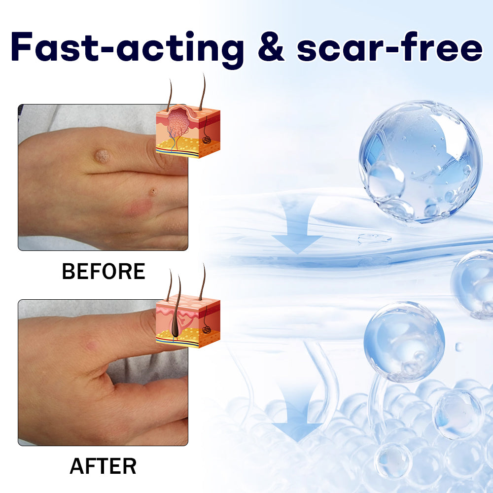 7视频🎅 𝘾𝙝𝙧𝙞𝙨𝙩𝙢𝙖𝙨 𝙎𝙖𝙡𝙚 | Cvreoz® WartLock CRYO RECOVERY SPRAY