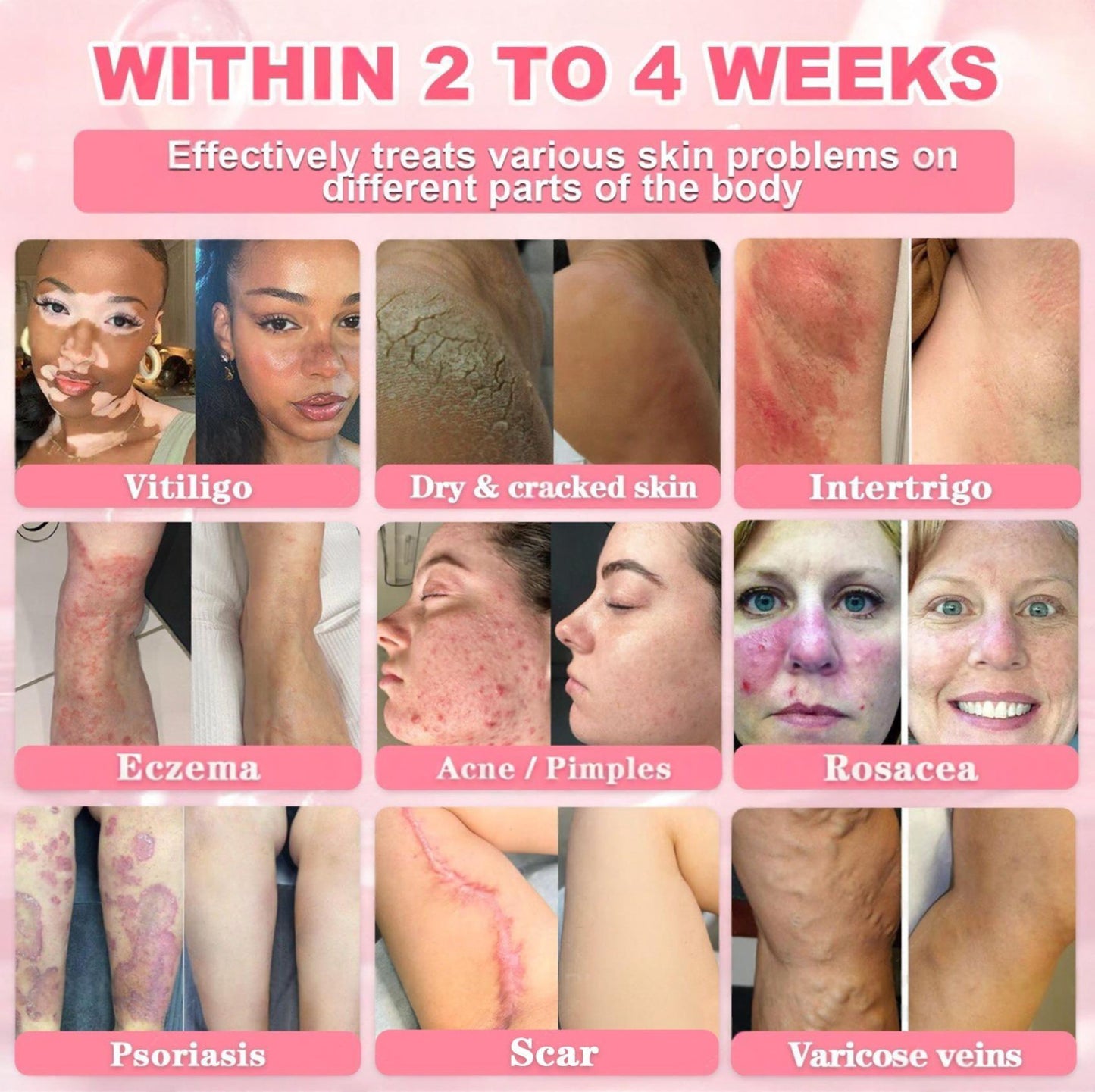 Cvreoz® 𝟗𝟗% 𝐩𝐮𝐫𝐞 𝐏𝐃𝐑𝐍 𝐒𝐚𝐥𝐦𝐨𝐧 𝐃𝐍𝐀 𝐀𝐧𝐭𝐢-𝐀𝐠𝐢𝐧𝐠 𝐀𝐦𝐩𝐨𝐮𝐥𝐞 𝘄𝗶𝘁𝗵 𝟵𝟵% 𝗦𝗮𝗹𝗺𝗼𝗻 𝗗𝗡𝗔 𝗣𝗗𝗥𝗡 + 𝗕𝗲𝗲 𝗩𝗲𝗻𝗼𝗺 · 𝟳𝗫 𝗗𝗲𝗲𝗽 𝗛𝘆𝗱𝗿𝗮𝘁𝗶𝗼𝗻 | 𝐓𝐚𝐫𝐠𝐞𝐭𝐬 𝐰𝐫𝐢𝐧𝐤𝐥𝐞𝐬, 𝐝𝐫𝐲𝐧𝐞𝐬𝐬, 𝐫𝐞𝐝𝐧𝐞𝐬𝐬, 𝐝𝐚𝐫𝐤 𝐬𝐩𝐨𝐭𝐬, 𝐩𝐮𝐫𝐩𝐮𝐫𝐚, 𝐢𝐧𝐟𝐥𝐚𝐦𝐦𝐚𝐭𝐢𝐨𝐧, 𝐚𝐧𝐝 𝐦𝐨𝐫𝐞 — 𝐕𝐢𝐬𝐢𝐛𝐥𝐞 𝐑𝐞𝐬𝐮𝐥𝐭𝐬 𝐢𝐧 𝟕 𝐃𝐚𝐲𝐬