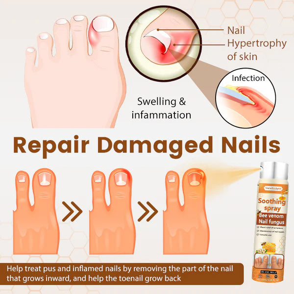 Cvreoz® Bee Venom Nail Fungus Spray
