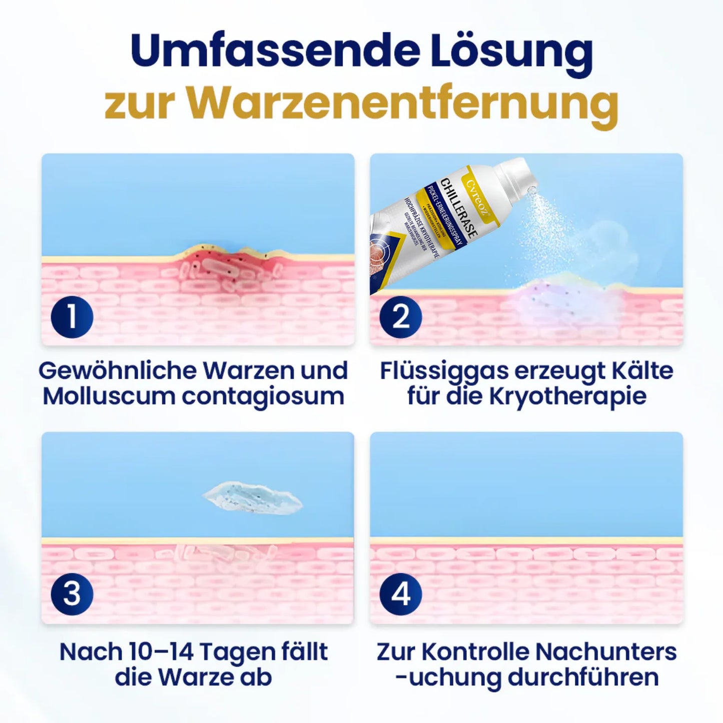 Fivfivgo® ChillErase Pickel-Erneuerungsspray