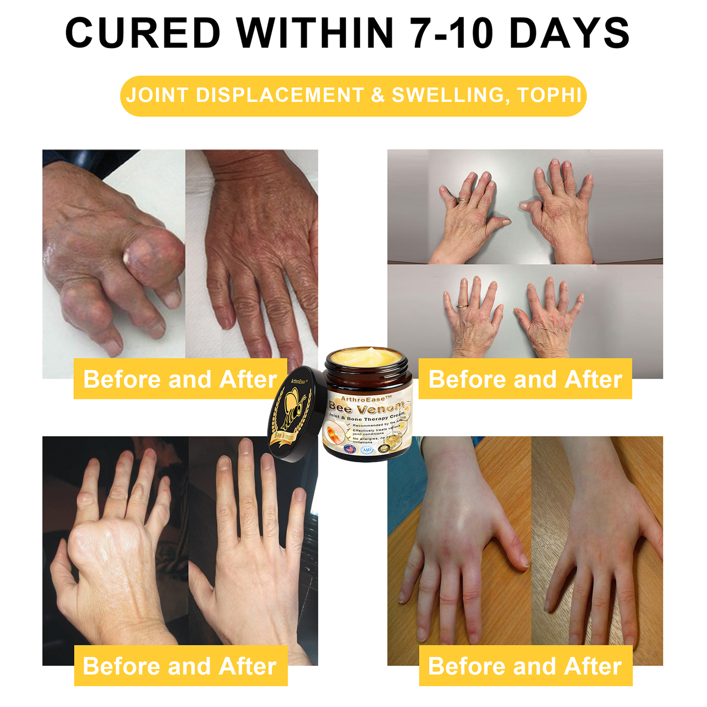 Official Store: ArthroEase™ Bee Venom Arthritis Therapy Cream (Joint & Bone Pain Relief in 24 Seconds)