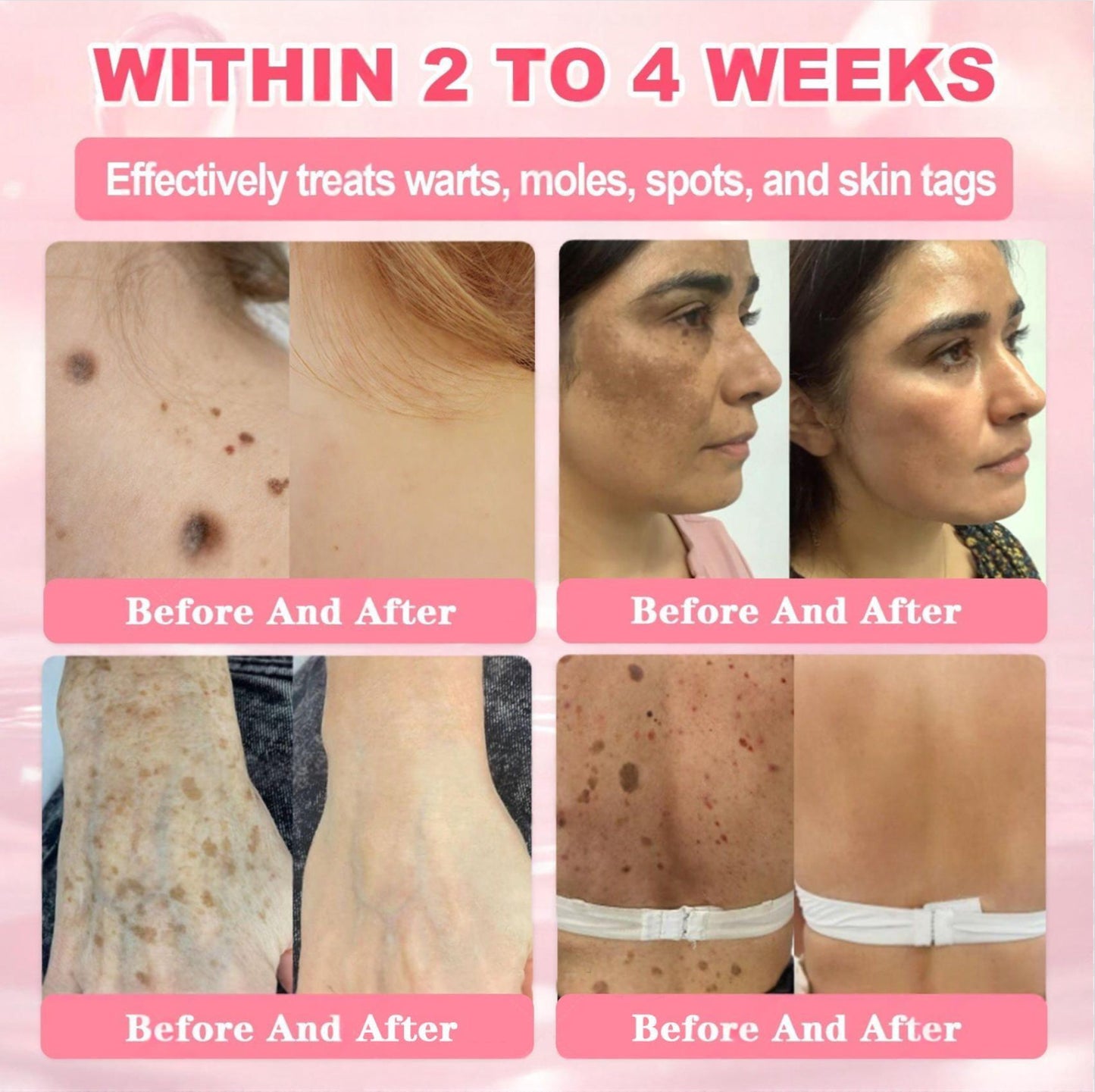 Cvreoz® 𝟗𝟗% 𝐩𝐮𝐫𝐞 𝐏𝐃𝐑𝐍 𝐒𝐚𝐥𝐦𝐨𝐧 𝐃𝐍𝐀 𝐀𝐧𝐭𝐢-𝐀𝐠𝐢𝐧𝐠 𝐀𝐦𝐩𝐨𝐮𝐥𝐞 𝘄𝗶𝘁𝗵 𝟵𝟵% 𝗦𝗮𝗹𝗺𝗼𝗻 𝗗𝗡𝗔 𝗣𝗗𝗥𝗡 + 𝗕𝗲𝗲 𝗩𝗲𝗻𝗼𝗺 · 𝟳𝗫 𝗗𝗲𝗲𝗽 𝗛𝘆𝗱𝗿𝗮𝘁𝗶𝗼𝗻 | 𝐓𝐚𝐫𝐠𝐞𝐭𝐬 𝐰𝐫𝐢𝐧𝐤𝐥𝐞𝐬, 𝐝𝐫𝐲𝐧𝐞𝐬𝐬, 𝐫𝐞𝐝𝐧𝐞𝐬𝐬, 𝐝𝐚𝐫𝐤 𝐬𝐩𝐨𝐭𝐬, 𝐩𝐮𝐫𝐩𝐮𝐫𝐚, 𝐢𝐧𝐟𝐥𝐚𝐦𝐦𝐚𝐭𝐢𝐨𝐧, 𝐚𝐧𝐝 𝐦𝐨𝐫𝐞 — 𝐕𝐢𝐬𝐢𝐛𝐥𝐞 𝐑𝐞𝐬𝐮𝐥𝐭𝐬 𝐢𝐧 𝟕 𝐃𝐚𝐲𝐬