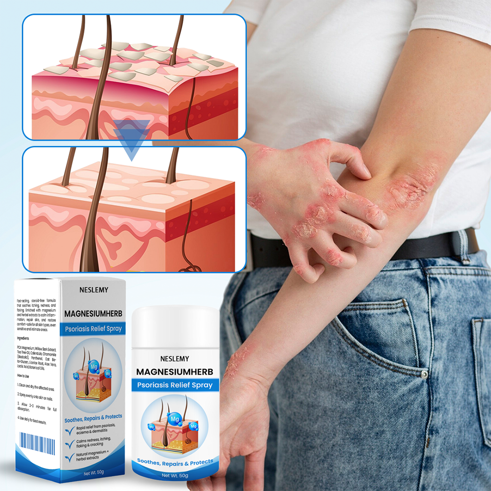 Cvreoz® MagnesiumHerb Psoriasis Relief Cream