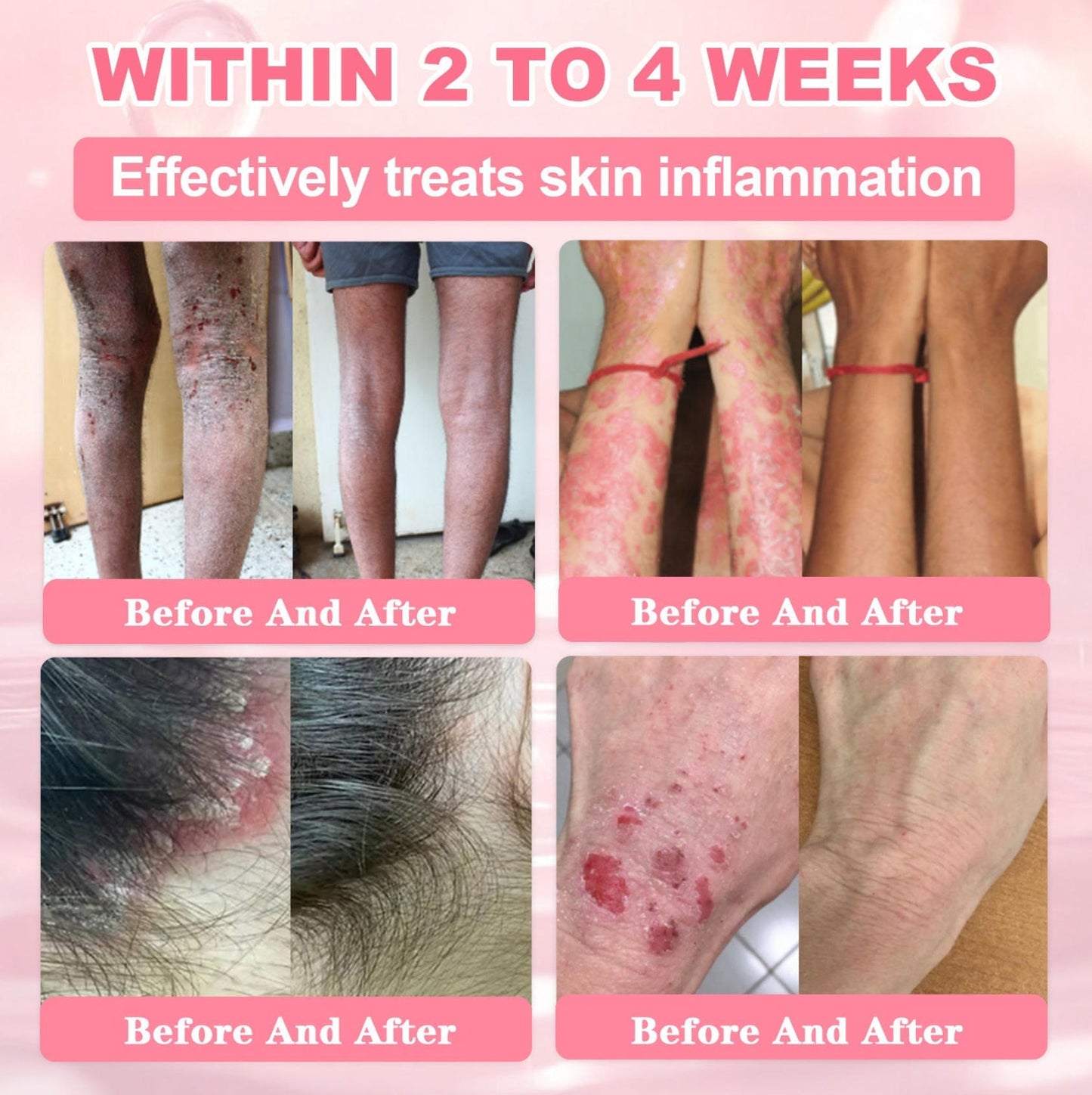 Cvreoz® 𝟗𝟗% 𝐩𝐮𝐫𝐞 𝐏𝐃𝐑𝐍 𝐒𝐚𝐥𝐦𝐨𝐧 𝐃𝐍𝐀 𝐀𝐧𝐭𝐢-𝐀𝐠𝐢𝐧𝐠 𝐀𝐦𝐩𝐨𝐮𝐥𝐞 𝘄𝗶𝘁𝗵 𝟵𝟵% 𝗦𝗮𝗹𝗺𝗼𝗻 𝗗𝗡𝗔 𝗣𝗗𝗥𝗡 + 𝗕𝗲𝗲 𝗩𝗲𝗻𝗼𝗺 · 𝟳𝗫 𝗗𝗲𝗲𝗽 𝗛𝘆𝗱𝗿𝗮𝘁𝗶𝗼𝗻 | 𝐓𝐚𝐫𝐠𝐞𝐭𝐬 𝐰𝐫𝐢𝐧𝐤𝐥𝐞𝐬, 𝐝𝐫𝐲𝐧𝐞𝐬𝐬, 𝐫𝐞𝐝𝐧𝐞𝐬𝐬, 𝐝𝐚𝐫𝐤 𝐬𝐩𝐨𝐭𝐬, 𝐩𝐮𝐫𝐩𝐮𝐫𝐚, 𝐢𝐧𝐟𝐥𝐚𝐦𝐦𝐚𝐭𝐢𝐨𝐧, 𝐚𝐧𝐝 𝐦𝐨𝐫𝐞 — 𝐕𝐢𝐬𝐢𝐛𝐥𝐞 𝐑𝐞𝐬𝐮𝐥𝐭𝐬 𝐢𝐧 𝟕 𝐃𝐚𝐲𝐬