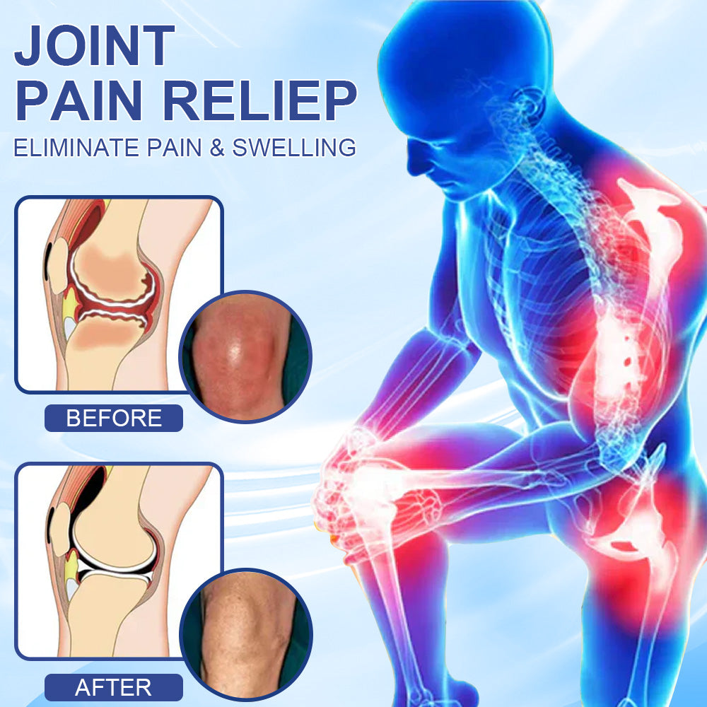 ✅Offiziell empfohlen: KUBOZN® Magnesium-Intensivcreme gegen Gelenk- und Nervenschmerzen (bei Arthrose, Neuropathie, Rheuma, Sportverletzungen u. v. m.)