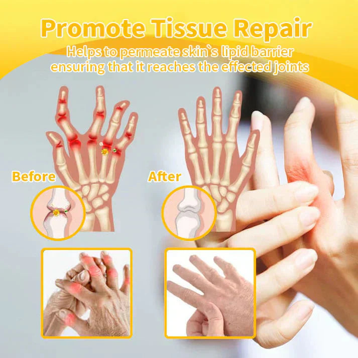 🇺🇸🏅  KUBOZN® MagniVen Magnesium & Bee Venom Joint Spray – 5 Min Relief · 7 Day Mobility · 4 Week Comfort