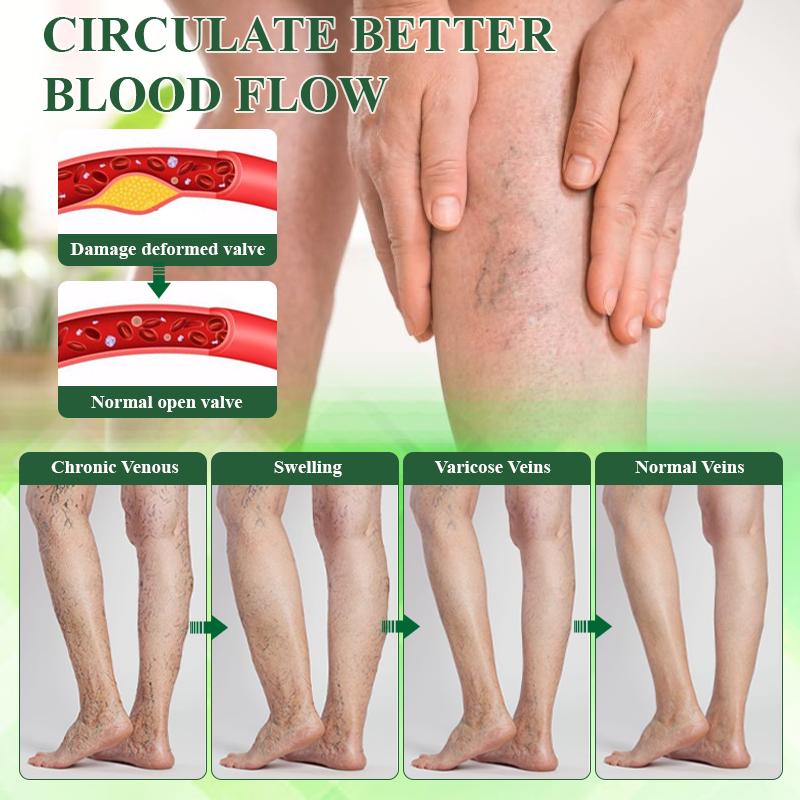 KUBOZN® Lymphatic Relief Roll-On Cream