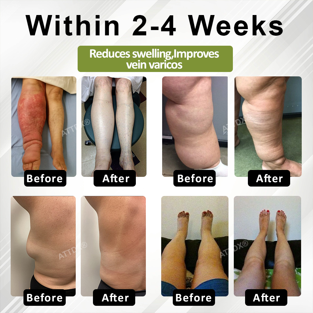KUBOZN® Lymphatic Relief Roll-On Cream