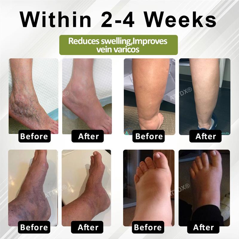 KUBOZN® Lymphatic Relief Roll-On Cream